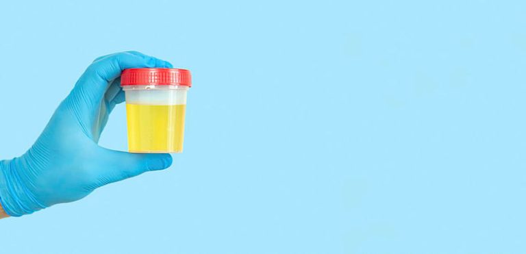 ‘Cliënt met veranderd gedrag of donkere urine? Laat de stick staan!’ UWI sticken in verpleeghuis: liever niet